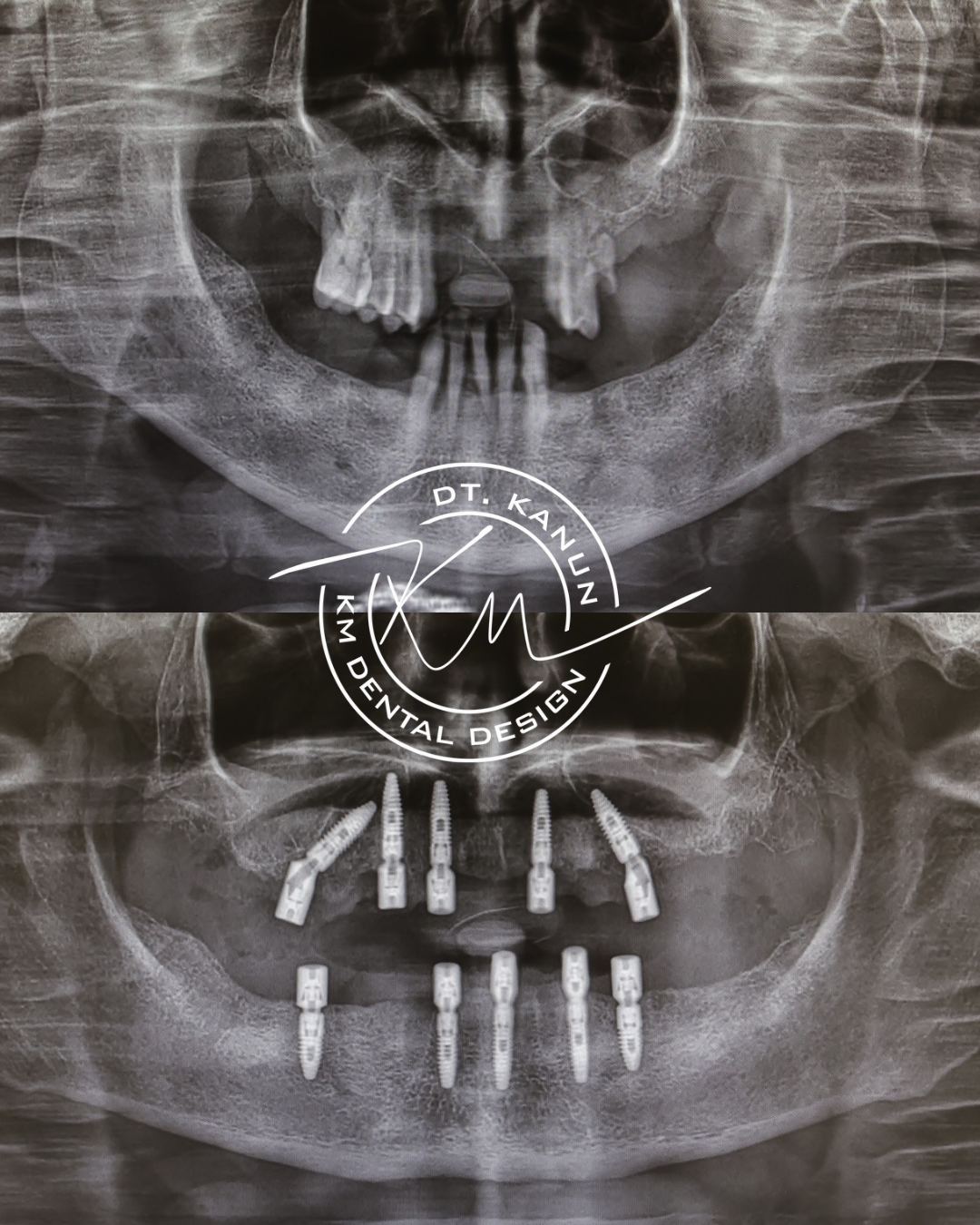 KM Dental Design - Before After 1