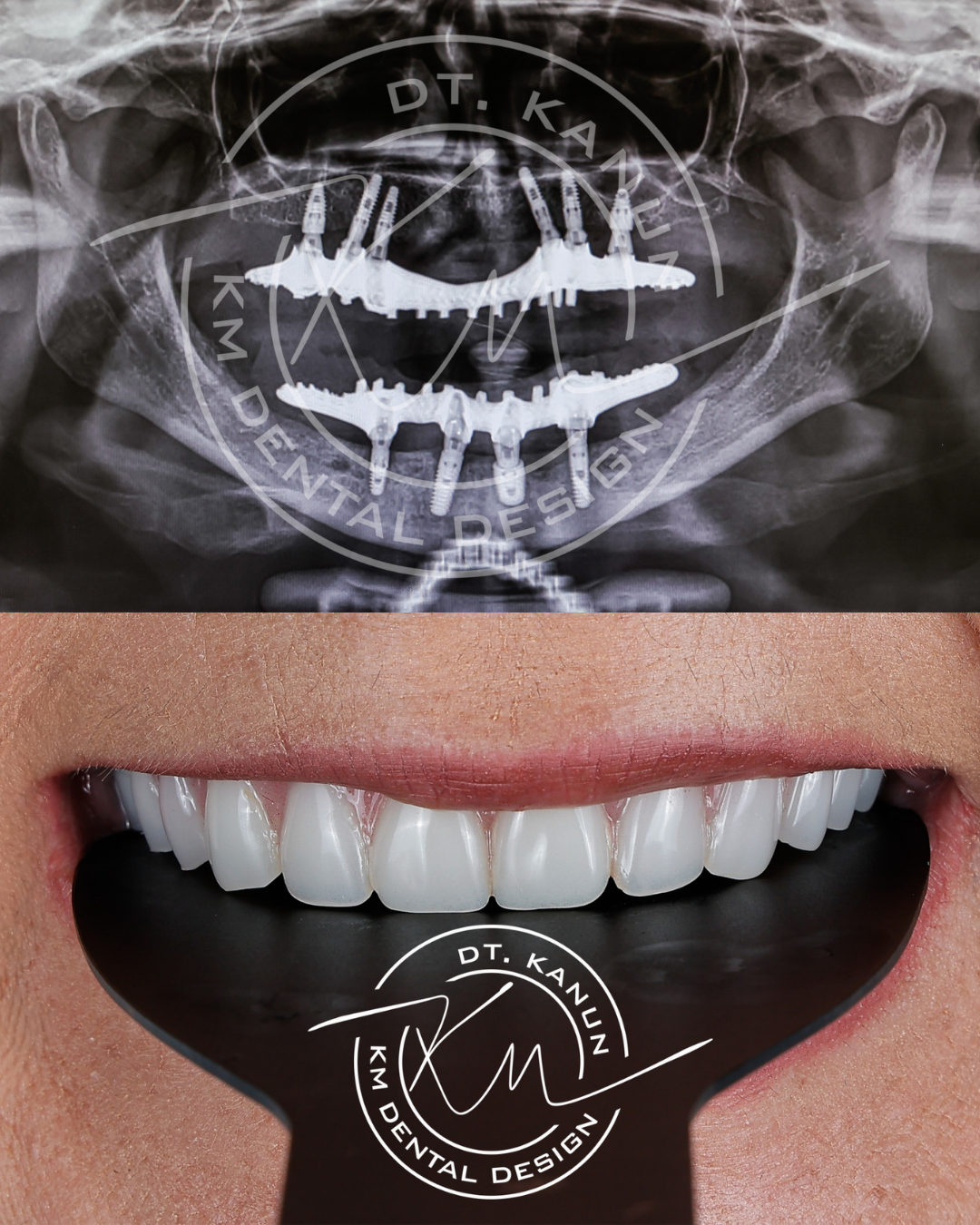 KM Dental Design - Before After 2